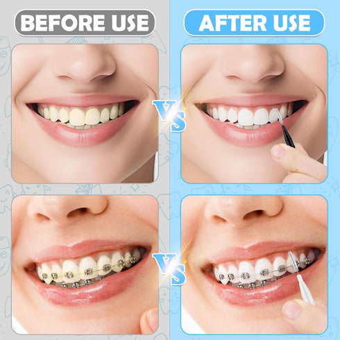 120Pcs Interdental Brushes, 360° Bendable Soft Bristles Braces Flossers Brush Dental Brushes Between Teeth Dental Floss Picks for Gum Braces Oral ...